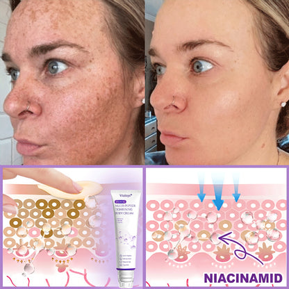 Vitalisys® PDRN Multi-Peptide Massaging Body Roller Cream ✅- Anti-aging, Hydrating, Skin Firming & Lifting, Skin Repair, Even Tone, Acne and Dark Spot Treatment, Wart and Mole Removal, and Psoriasis Relief 🌷