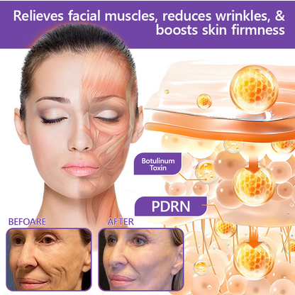 Vitalisys® PDRN Multi-Peptide Massaging Body Roller Cream ✅- Anti-aging, Hydrating, Skin Firming & Lifting, Skin Repair, Even Tone, Acne and Dark Spot Treatment, Wart and Mole Removal, and Psoriasis Relief 🌷