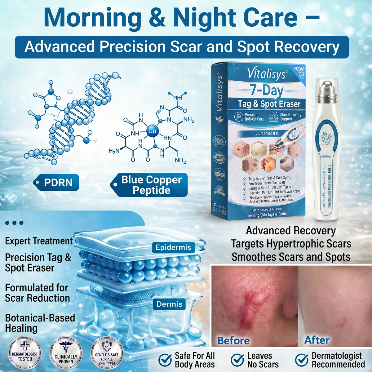 Authorized Flagship Store ✨|🍉𝐕𝐢𝐭𝐚𝐥𝐢𝐬𝐲𝐬® 7-𝐷𝑎𝑦 𝗧𝐚𝐠 & 𝗦𝗽𝐨𝐭 𝐄𝐫𝒂𝒔𝒆𝒓(Zero Pain, Zero 𝐒𝐜𝐚𝒓𝒔 Rollerball)|Removing moles, warts, facial wrinkles, bruises, scars✨