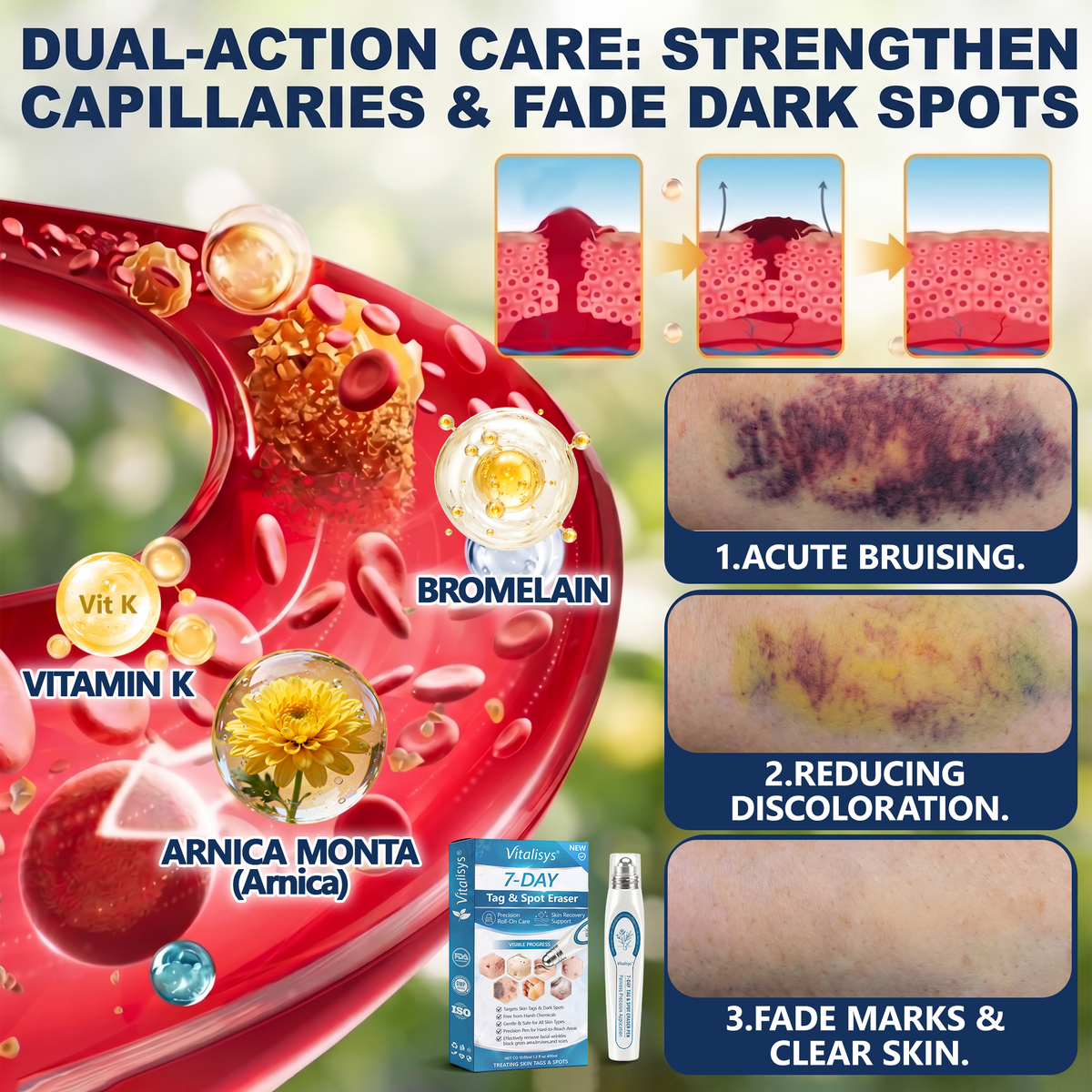 Authorized Flagship Store ✨|🍉𝐕𝐢𝐭𝐚𝐥𝐢𝐬𝐲𝐬® 7-𝐷𝑎𝑦 𝗧𝐚𝐠 & 𝗦𝗽𝐨𝐭 𝐄𝐫𝒂𝒔𝒆𝒓(Zero Pain, Zero 𝐒𝐜𝐚𝒓𝒔 Rollerball)|Removing moles, warts, facial wrinkles, bruises, scars✨