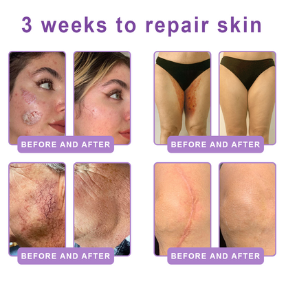 Vitalisys® PDRN Multi-Peptide Massaging Body Roller Cream ✅- Anti-aging, Hydrating, Skin Firming & Lifting, Skin Repair, Even Tone, Acne and Dark Spot Treatment, Wart and Mole Removal, and Psoriasis Relief 🌷