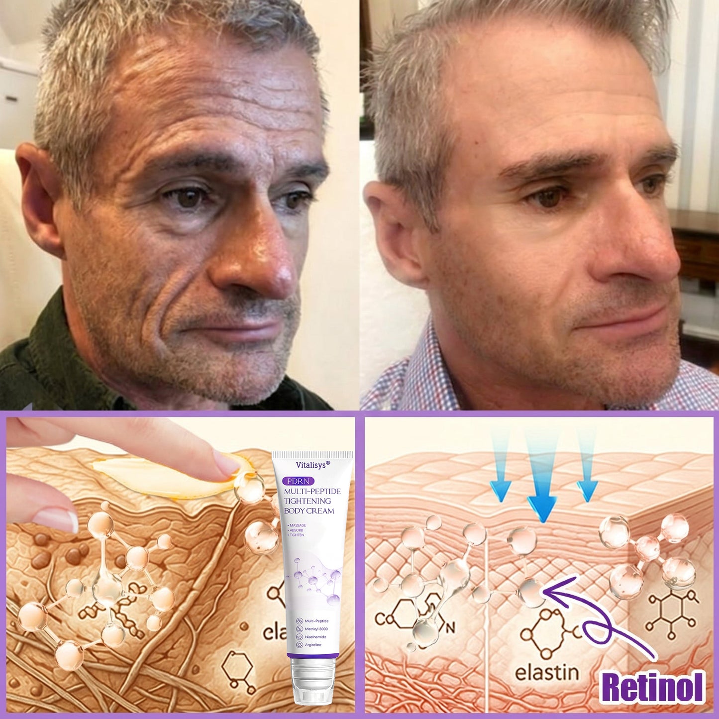 Vitalisys® PDRN Multi-Peptide Massaging Body Roller Cream ✅- Anti-aging, Hydrating, Skin Firming & Lifting, Skin Repair, Even Tone, Acne and Dark Spot Treatment, Wart and Mole Removal, and Psoriasis Relief 🌷